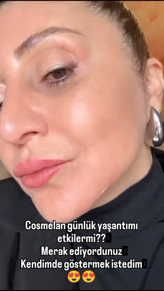 Post 7 by Selmagül Estetik 🌹  Güzellik Merkezi Eğitim Mentor on Instagram (video)