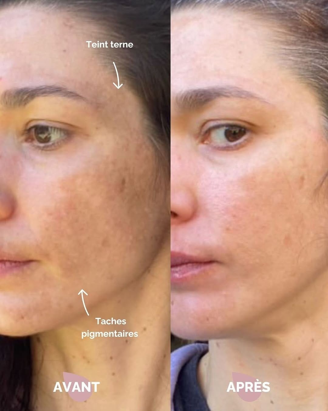 Post 6 by Le Petit Med Spa on Instagram (image)