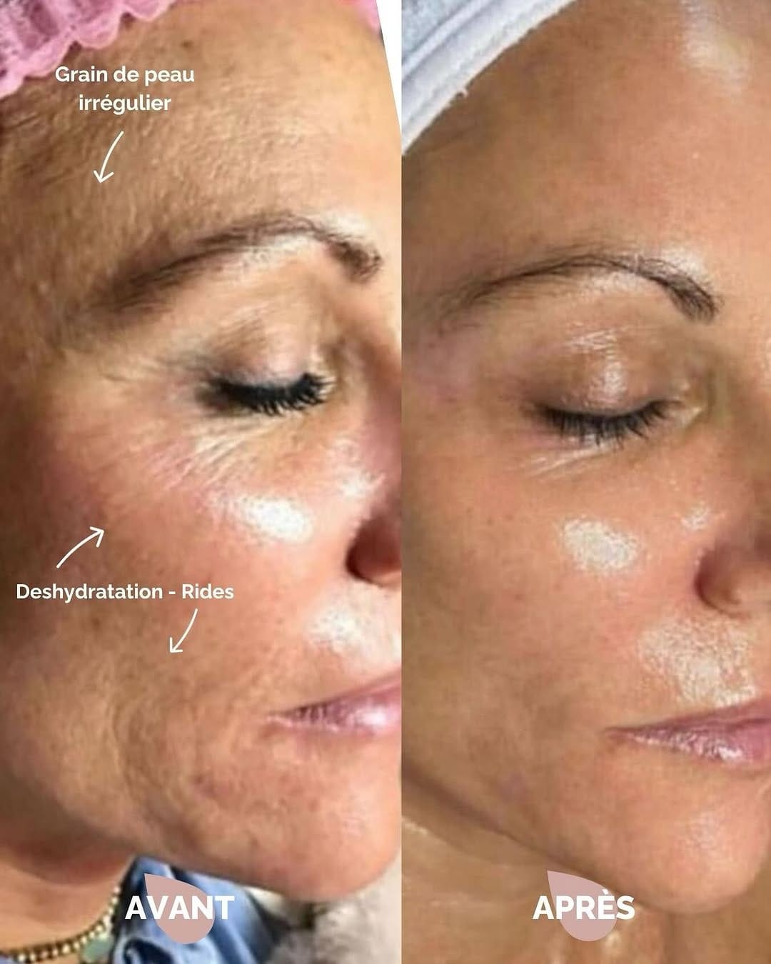 Post 4 by Le Petit Med Spa on Instagram (image)