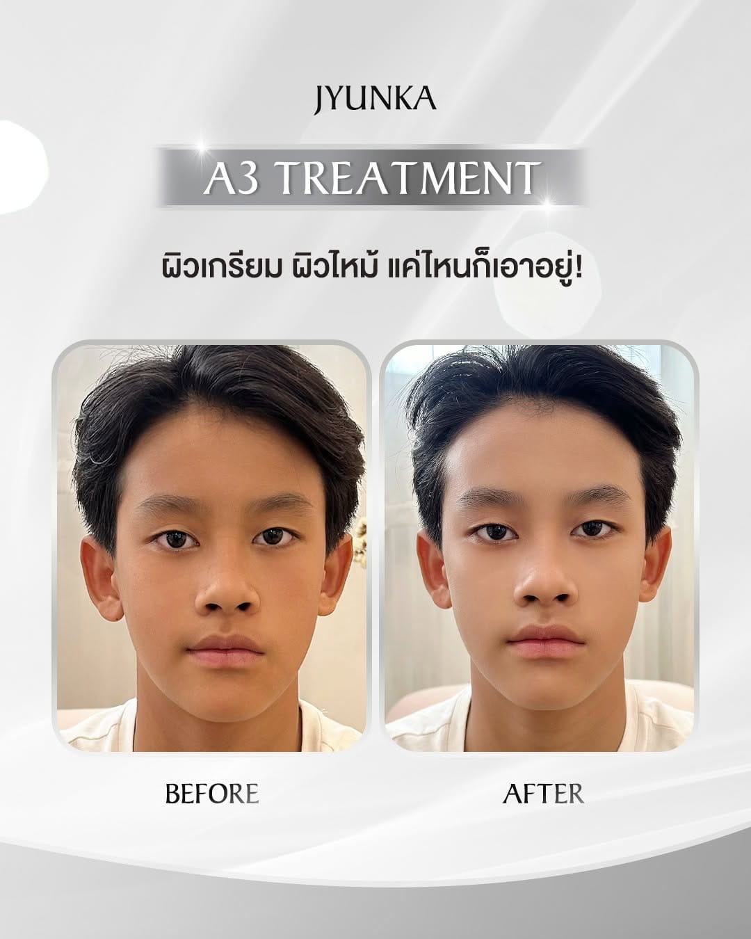 Post 10 by Jyunka Thailand on Instagram (image)