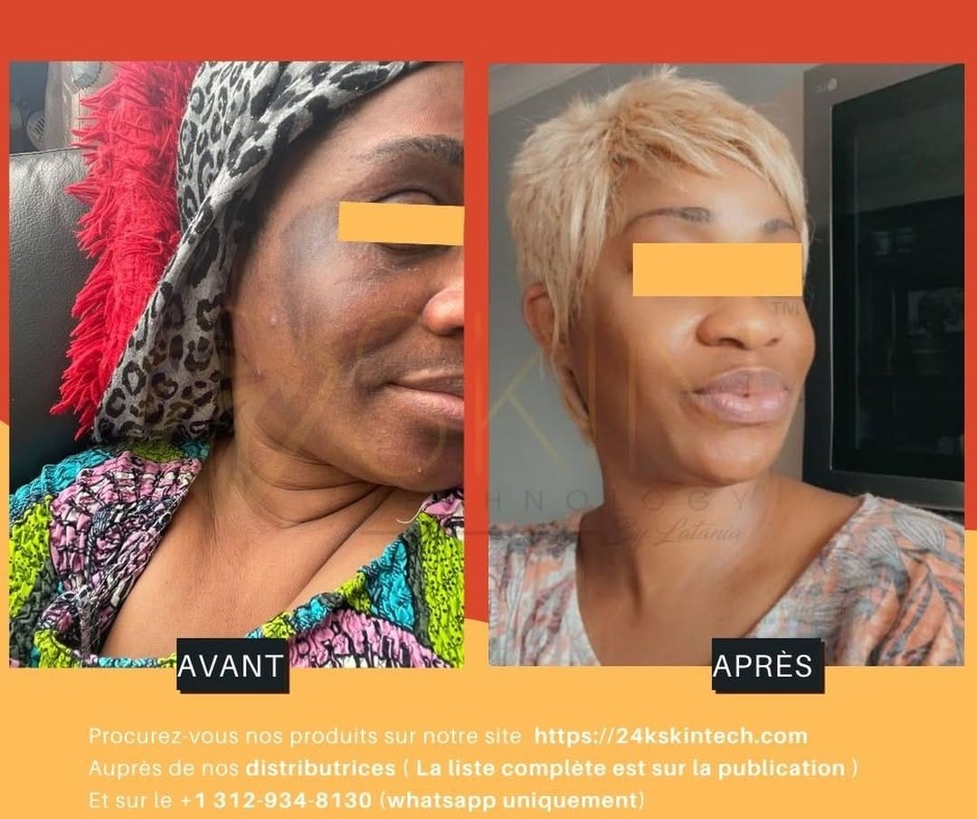 Post 9 by Skin Technology By LaTania on Instagram (image)