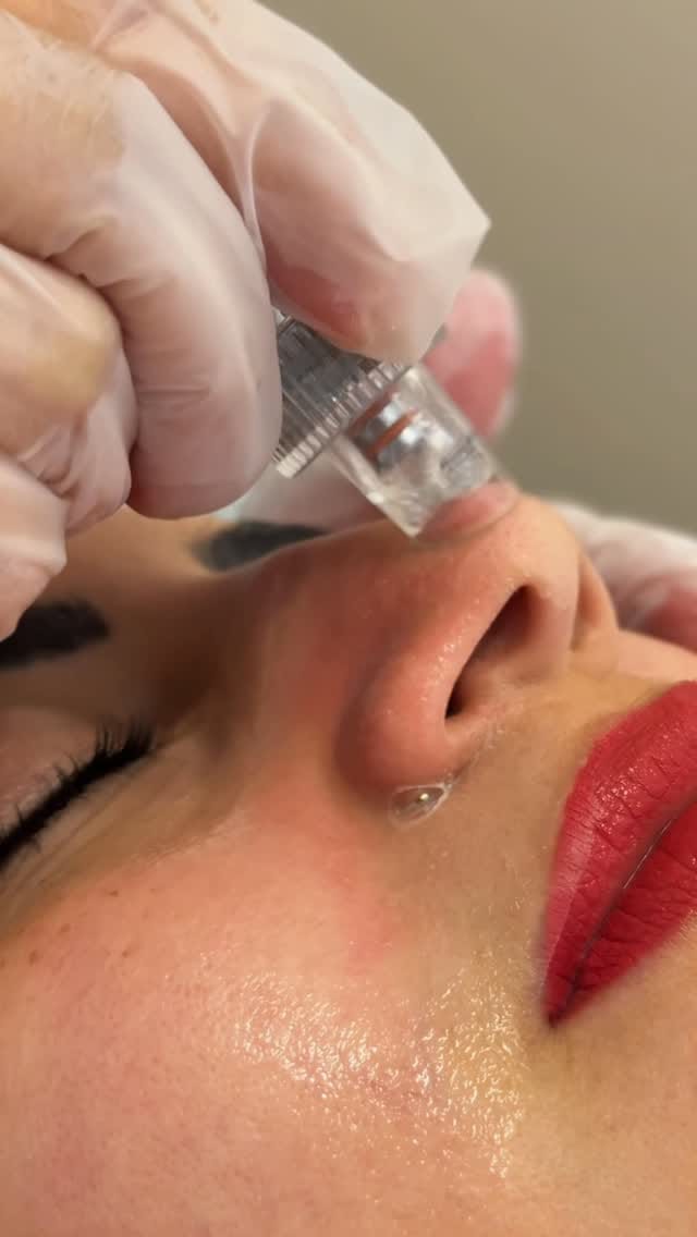 Post 3 by Medicina Estética y Antienvejecimiento on Instagram (video)
