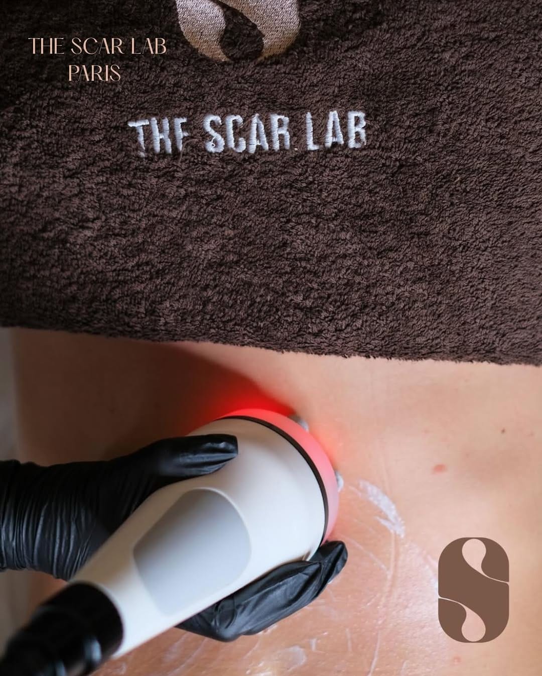 Post 5 by The Scar Lab on Instagram (image)