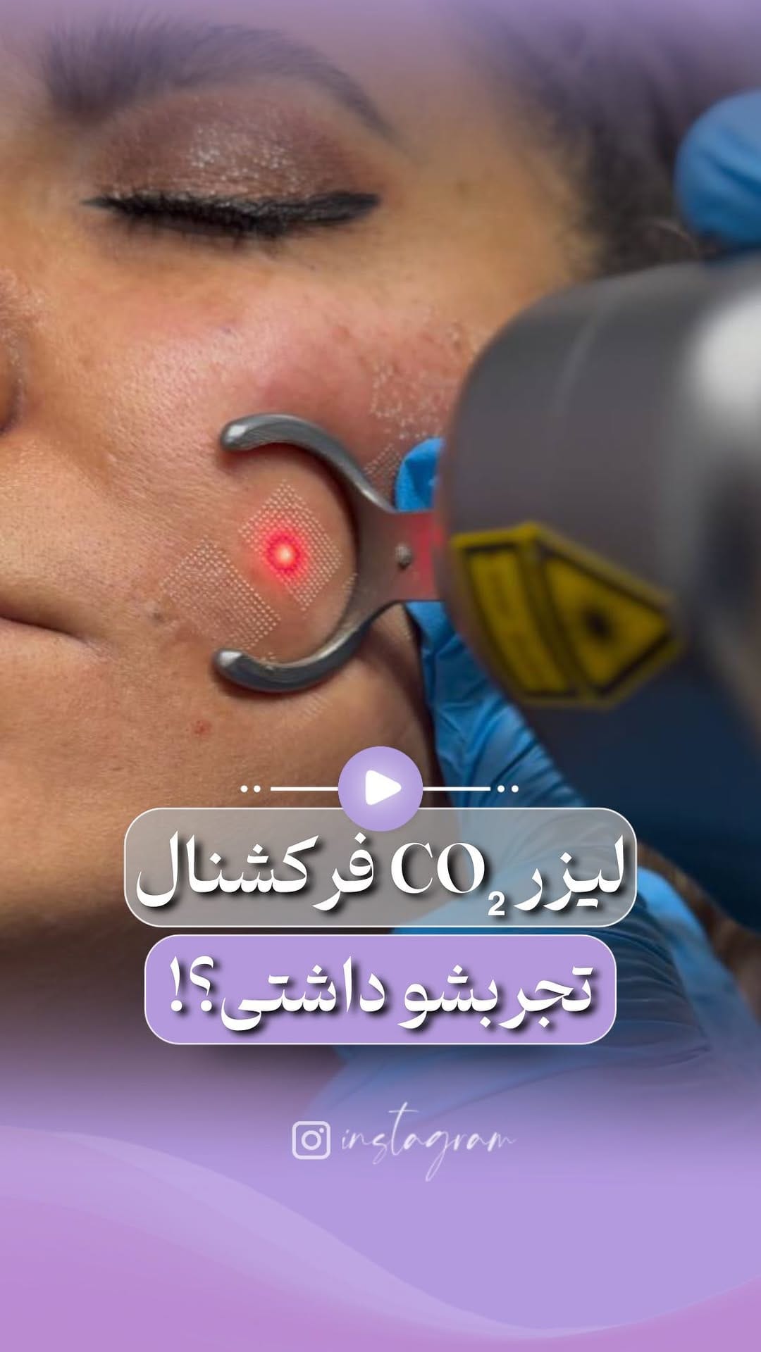 Post 2 by 💜کلینیک عطرا💜 on Instagram (video)