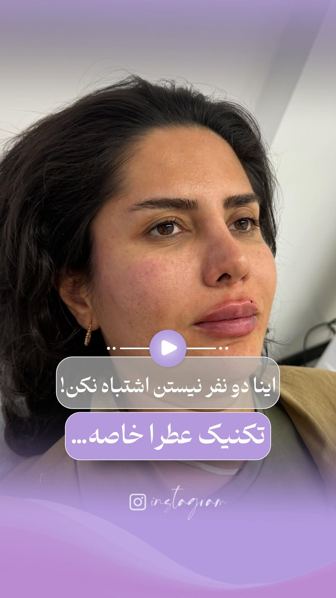 Post 9 by 💜کلینیک عطرا💜 on Instagram (video)