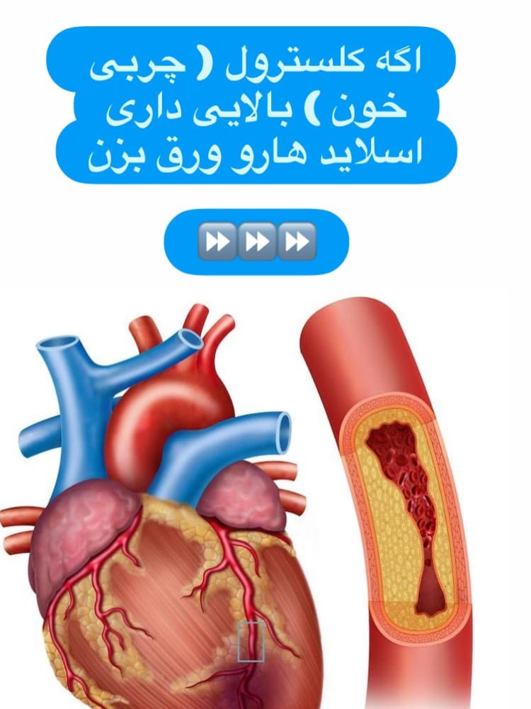 Post 1 by پریسا گرایلی /رژیم درمانگر /چاقی/ لاغری on Instagram (carousel)
