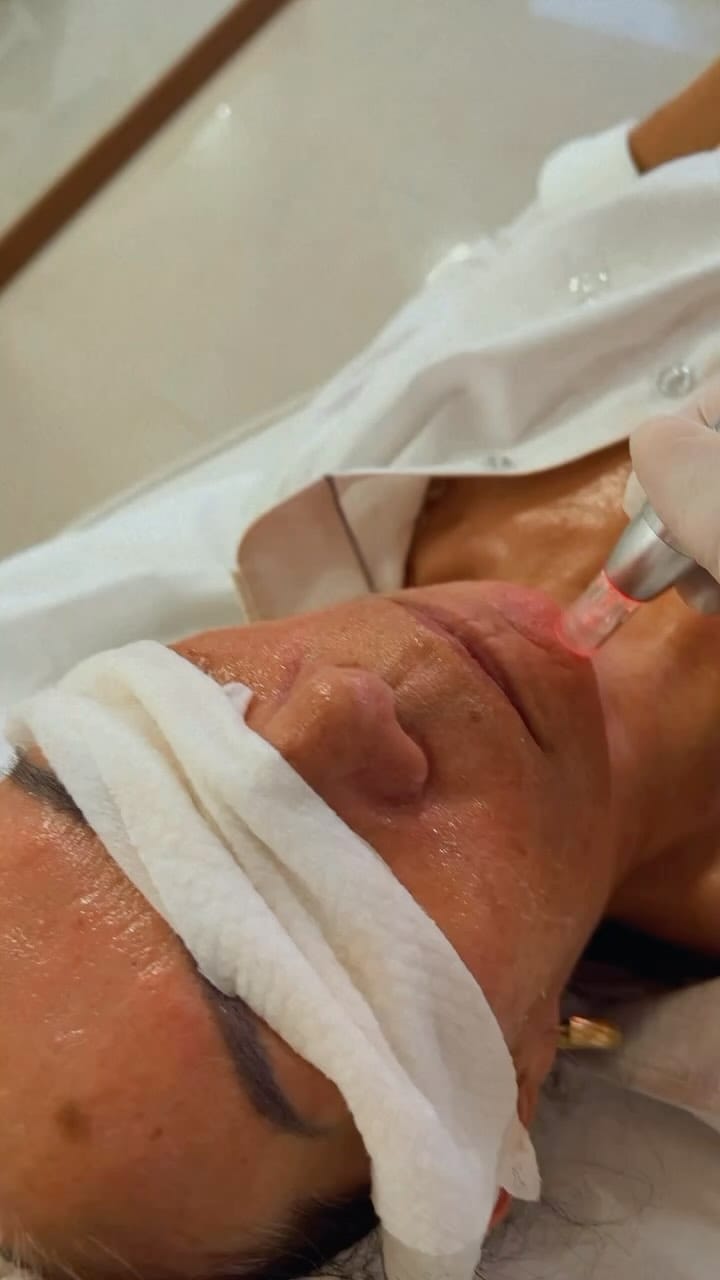 Post 9 by DRA.TÂNIA BAGGIO🇧🇷🇺🇸  MICROPIGMENTAÇÃO & DESIGN DE SOBRANCELHAS on Instagram (video)