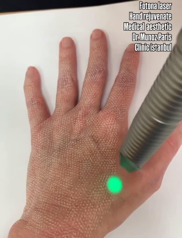 Post 1 by Aesthetic and Antiaging Clinic, Istanbul on Instagram (video)
