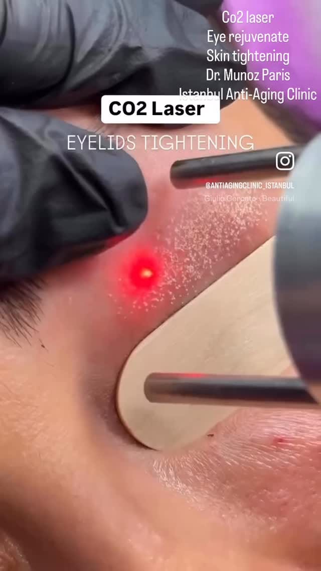 Post 3 by Aesthetic and Antiaging Clinic, Istanbul on Instagram (video)