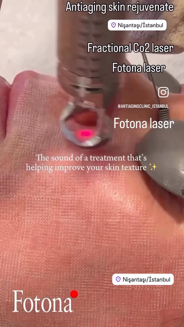 Post 5 by Aesthetic and Antiaging Clinic, Istanbul on Instagram (video)