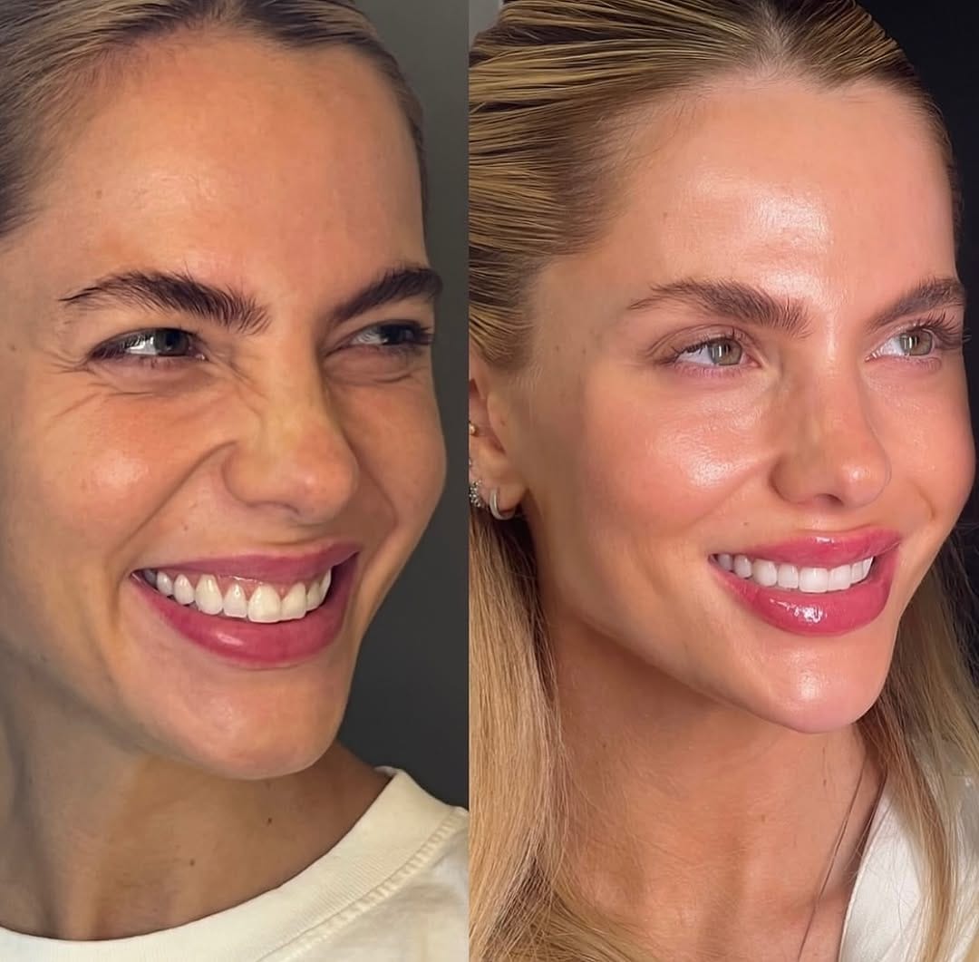 Post 8 by Aesthetic and Antiaging Clinic, Istanbul on Instagram (image)