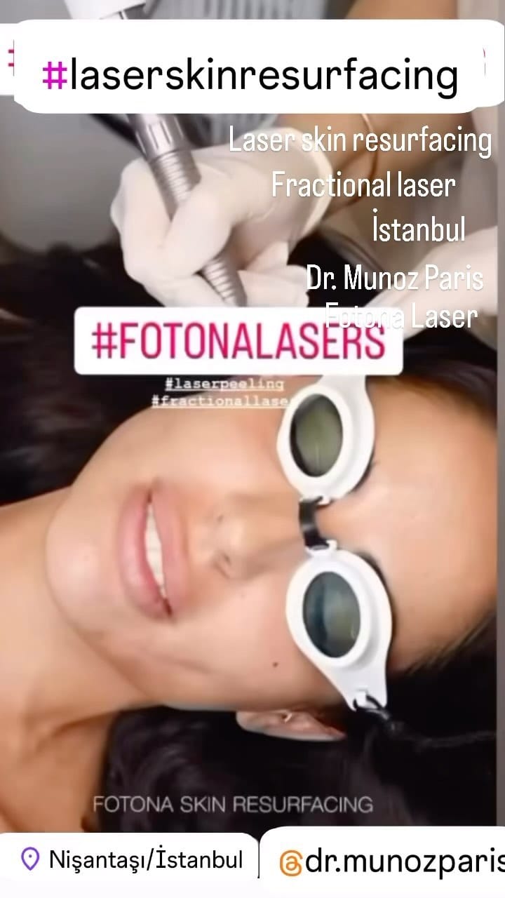Post 9 by Aesthetic and Antiaging Clinic, Istanbul on Instagram (video)