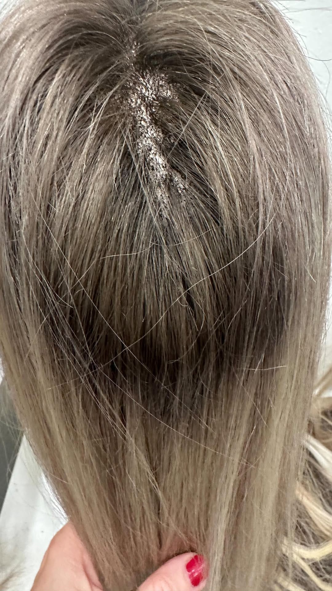 Post 7 by ChristenB alopecie,calvitie on Instagram (video)
