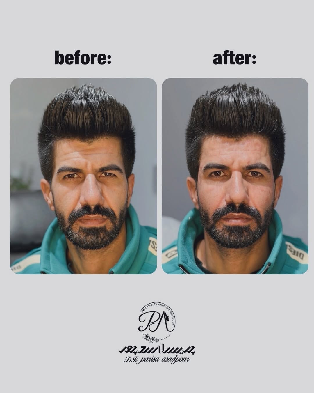 Post 8 by dr_parisaasadpor | دکتر پریسا اسدپور on Instagram (carousel)