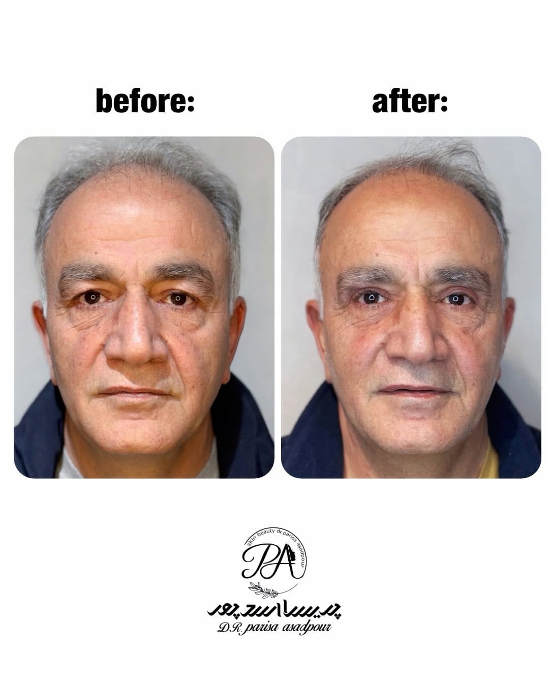Post 5 by dr_parisaasadpor | دکتر پریسا اسدپور on Instagram (carousel)