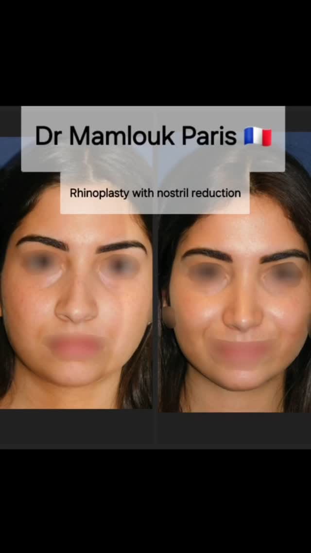 Post 7 by Karim MAMLOUK on Instagram (video)