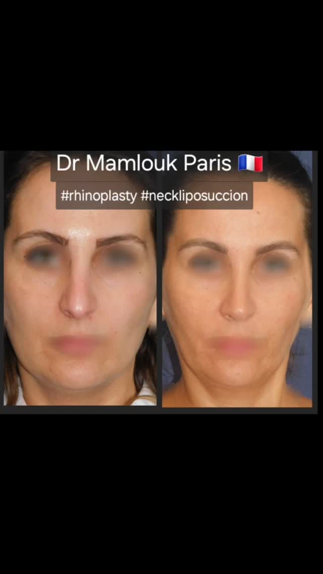 Post 8 by Karim MAMLOUK on Instagram (video)
