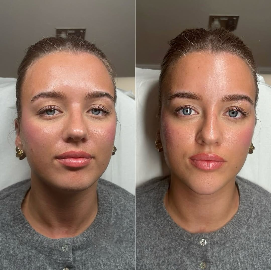Post 3 by ＦＡＣＥＤ by Francesca on Instagram (image)