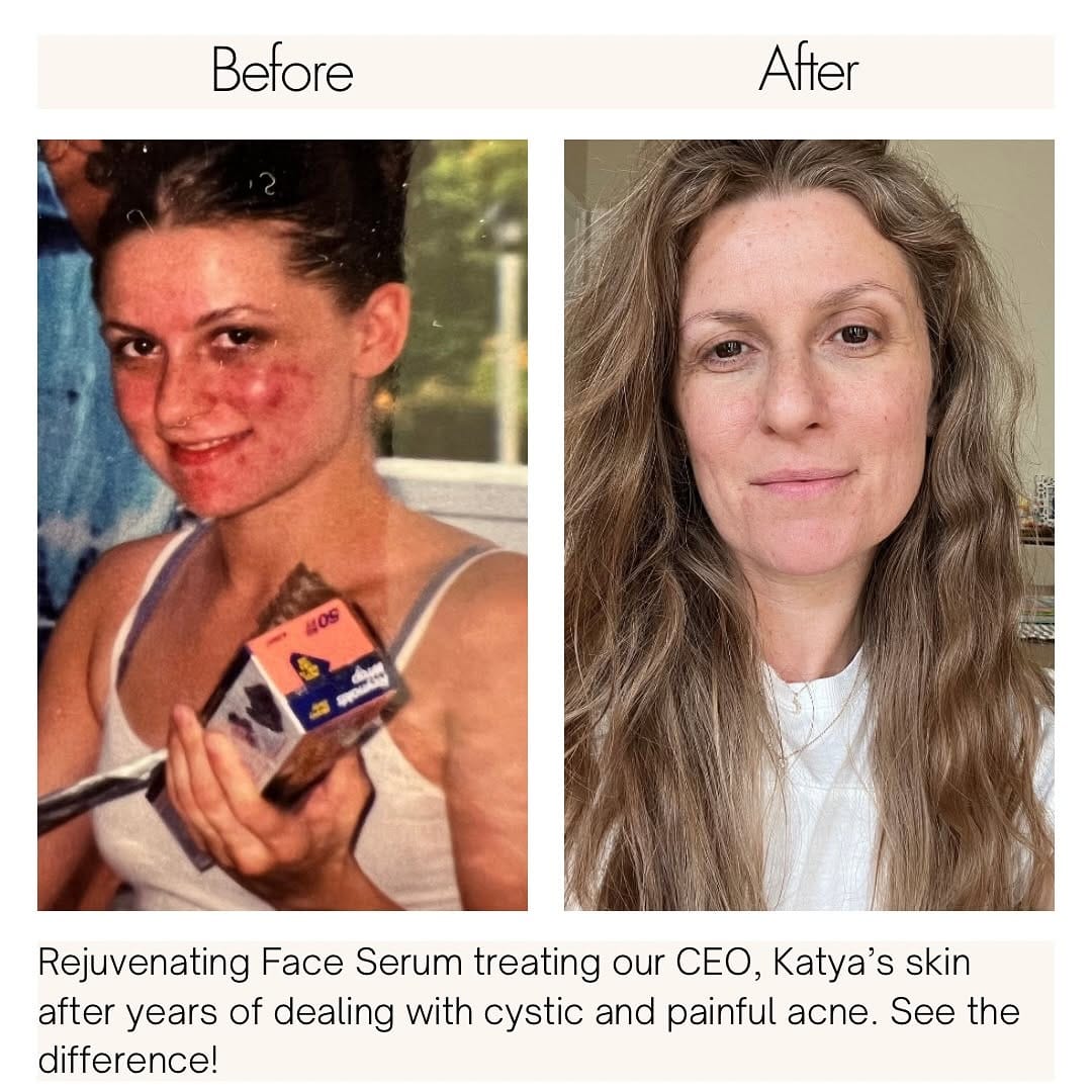 Post 8 by MALAYA ORGANICS on Instagram (image)