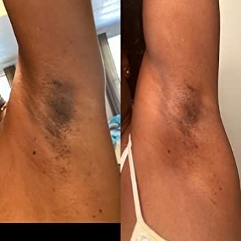 Post 8 by Glow Beauty Care on Instagram (image)