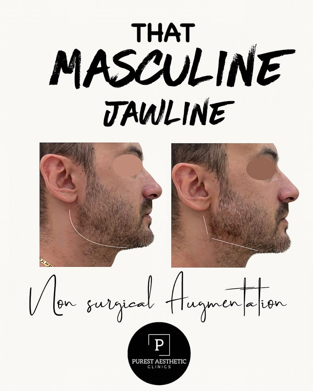 Post 3 by 𝗣𝗨𝗥𝗘𝗦𝗧 𝗔𝗘𝗦𝗧𝗛𝗘𝗧𝗜𝗖 𝗖𝗟𝗜𝗡𝗜𝗖𝗦 on Instagram (image)