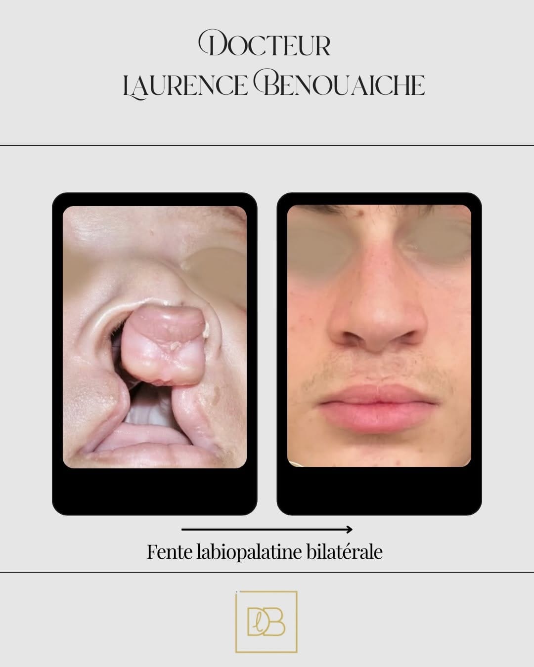 Post 1 by Dr Laurence Benouaiche on Instagram (carousel)