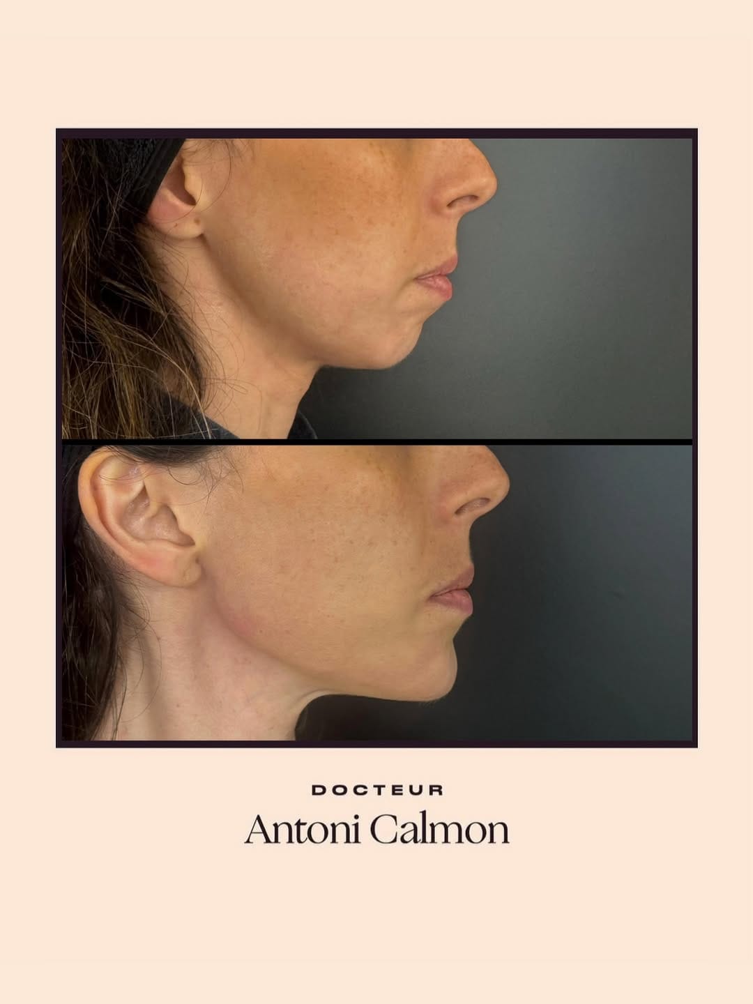 Post 5 by Dr Antoni Calmon on Instagram (image)