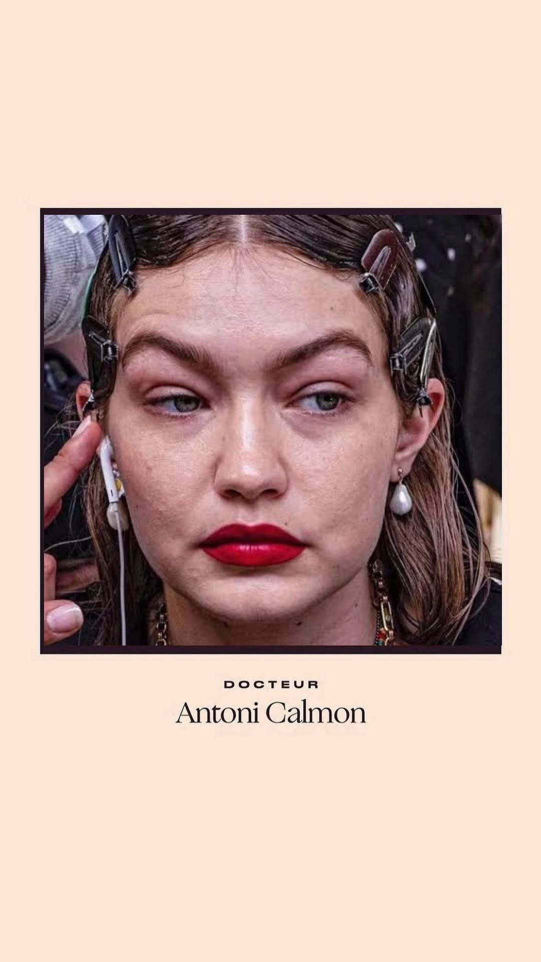 Post 8 by Dr Antoni Calmon on Instagram (video)