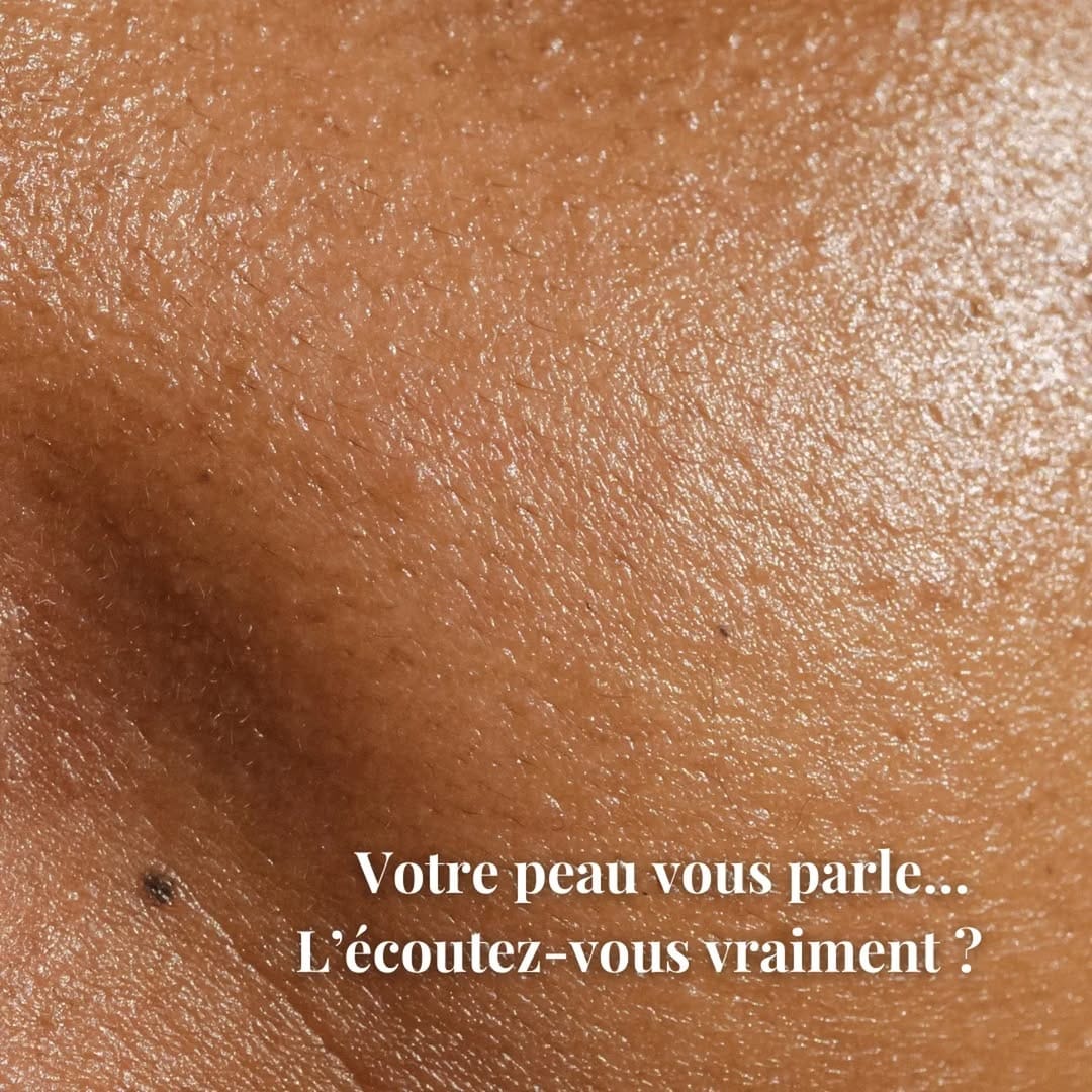 Post 3 by Savonnerie Artisanale du Jura on Instagram (image)