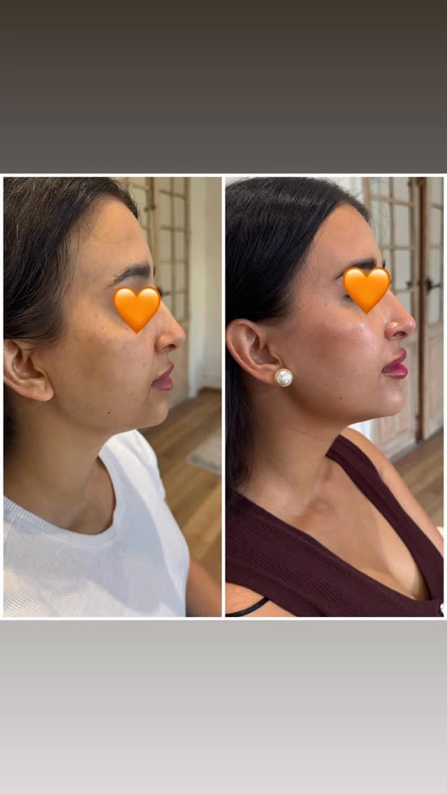 Post 8 by Dr PRUZSINA ARIS on Instagram (video)