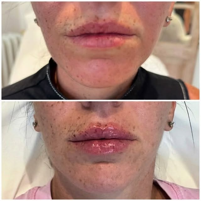 Post 6 by Dr PRUZSINA ARIS on Instagram (video)