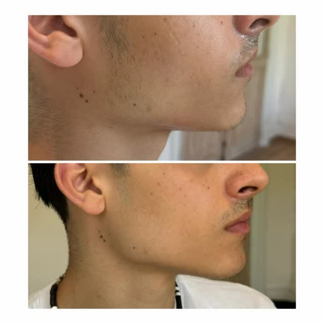 Post 3 by Dr PRUZSINA ARIS on Instagram (video)