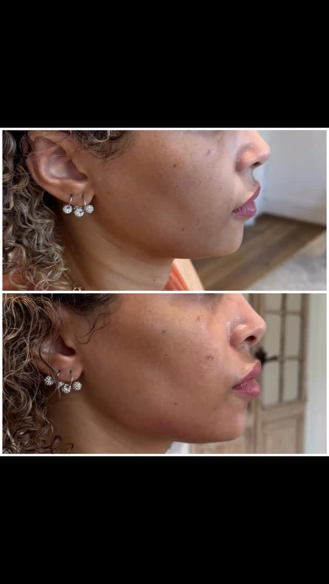 Post 9 by Dr PRUZSINA ARIS on Instagram (video)