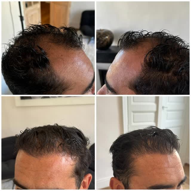 Post 4 by Dr PRUZSINA ARIS on Instagram (video)