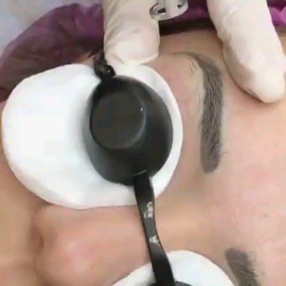 Post 7 by viva laser aluguel de maquinas depilaçao e despigmentação on Instagram (video)
