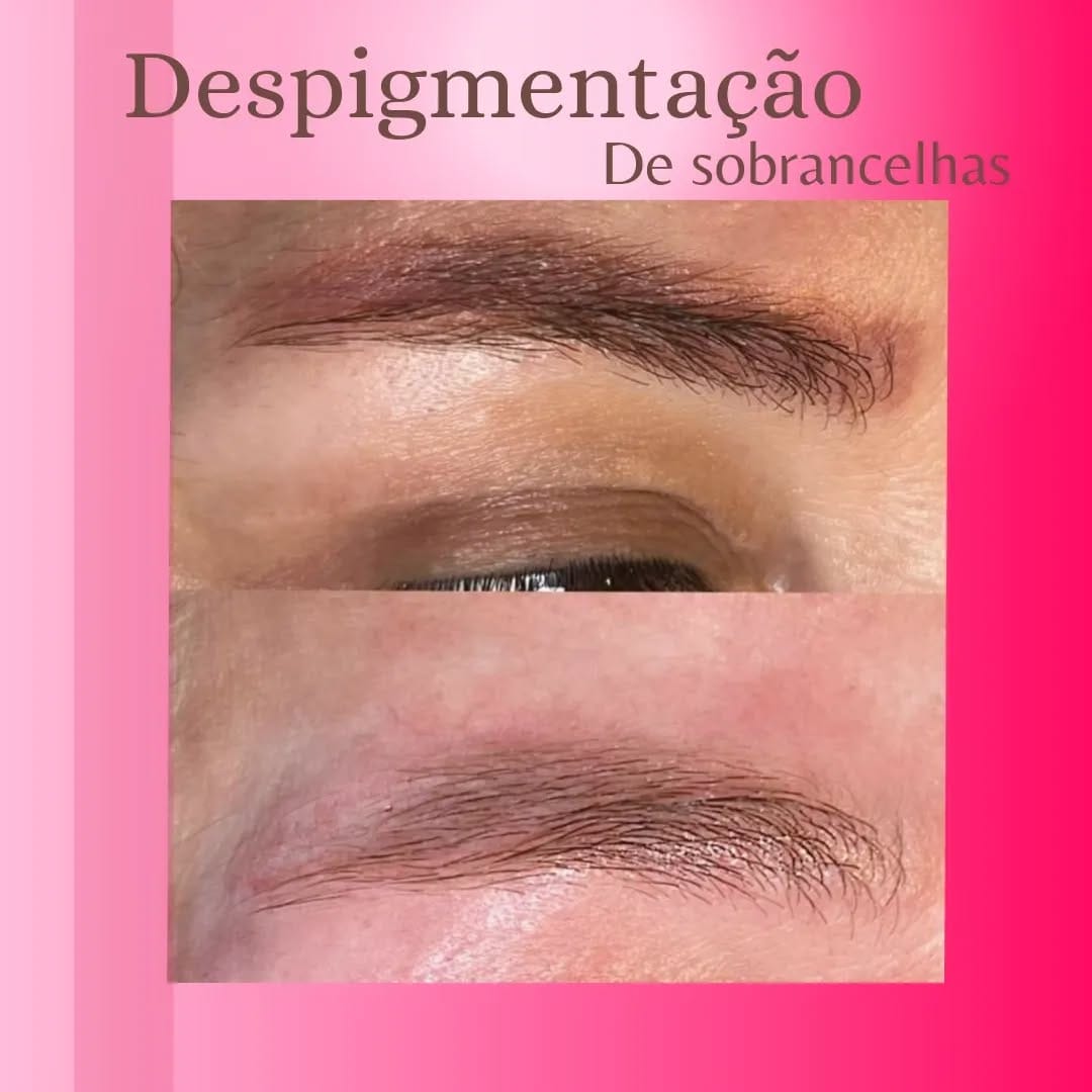 Post 4 by viva laser aluguel de maquinas depilaçao e despigmentação on Instagram (image)