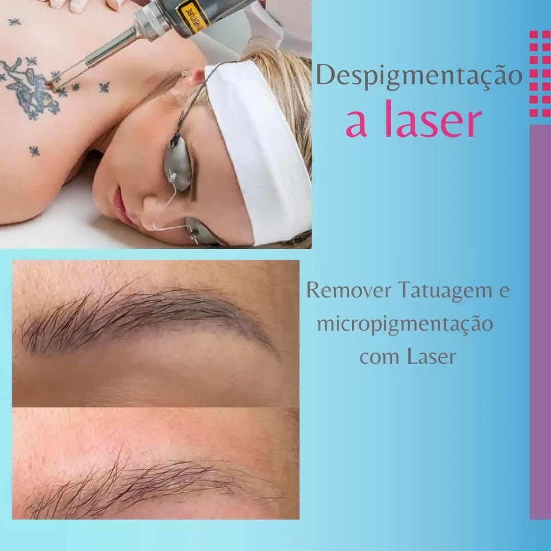 Post 10 by viva laser aluguel de maquinas depilaçao e despigmentação on Instagram (image)