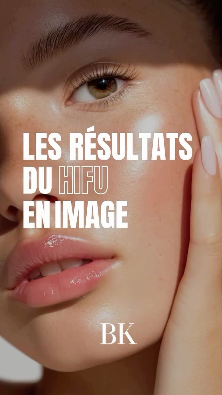 Post 8 by PARIS | RUSSIAN MANUCURE |COSMETOLOGY |LIFTING |ÉPILATION LASER on Instagram (video)