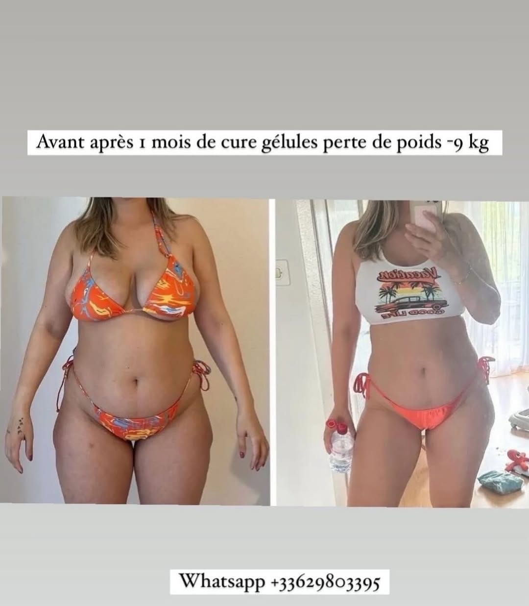 Post 9 by Bodycontouring /skincare/ aesthetic on Instagram (image)