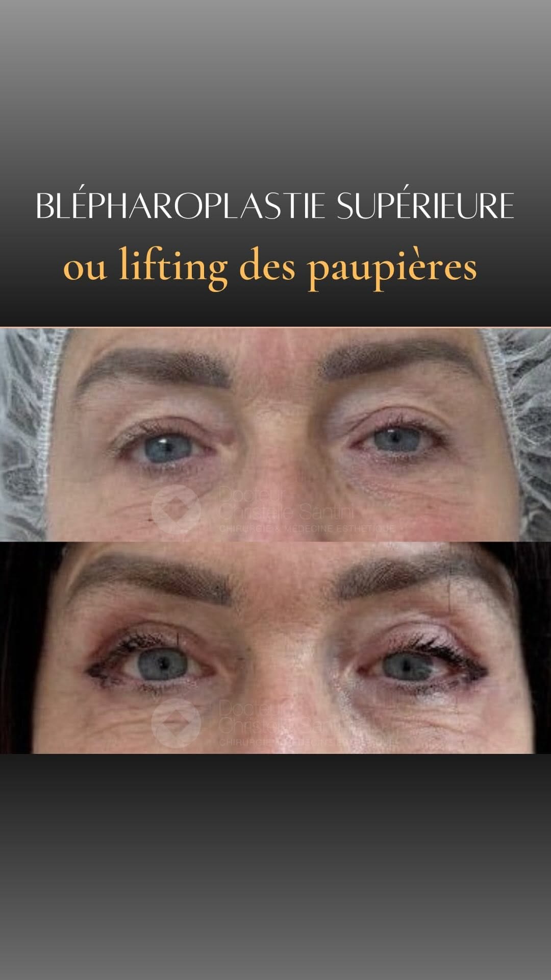 Post 5 by Christelle Santini on Instagram (video)