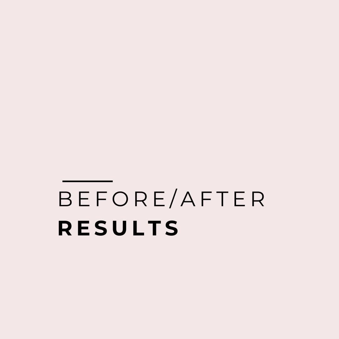 Post 4 by LPG endermologie America 🇺🇸 on Instagram (carousel)
