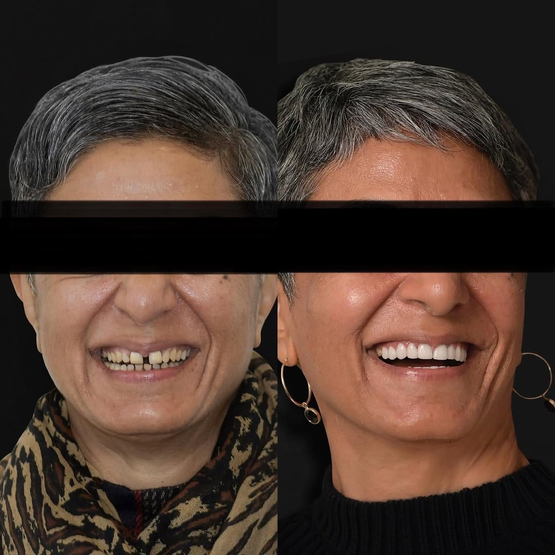 Post 2 by ELONE CLINIC-Dr. Ari Elhyani on Instagram (carousel)