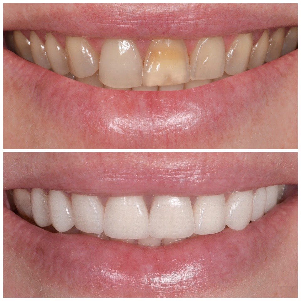 Post 10 by ELONE CLINIC-Dr. Ari Elhyani on Instagram (carousel)