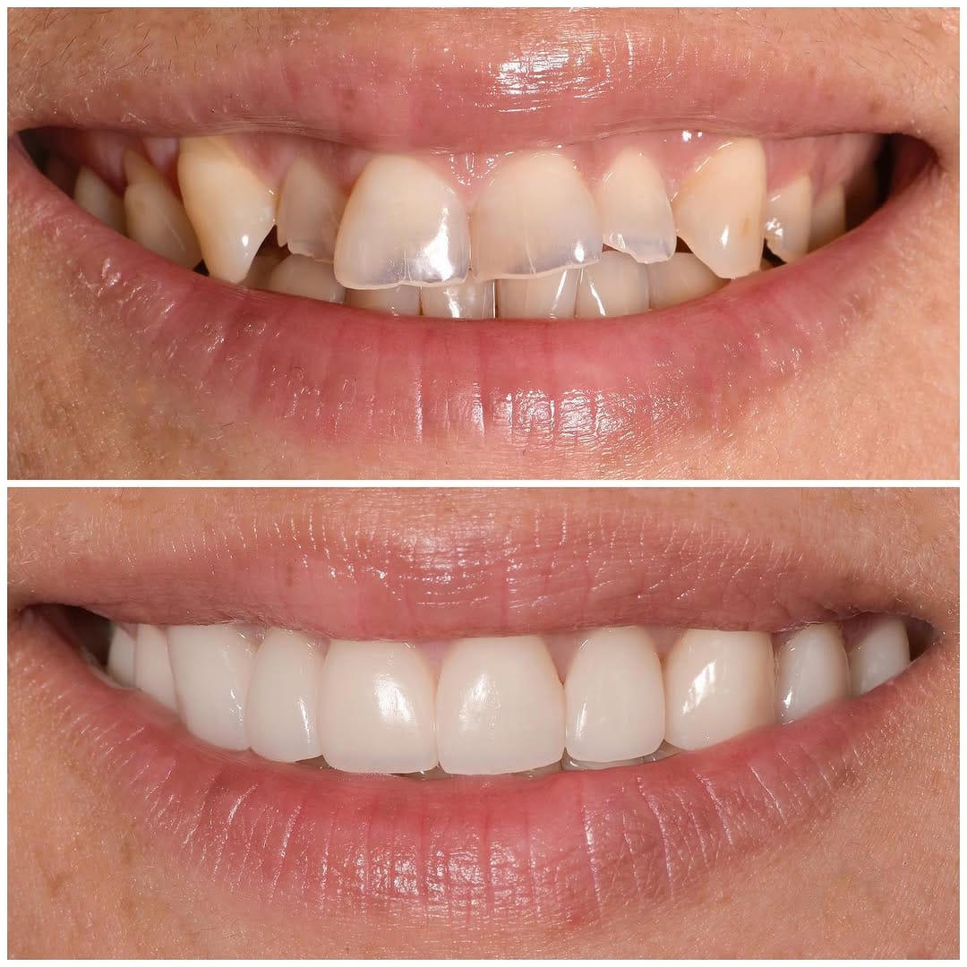 Post 5 by ELONE CLINIC-Dr. Ari Elhyani on Instagram (carousel)