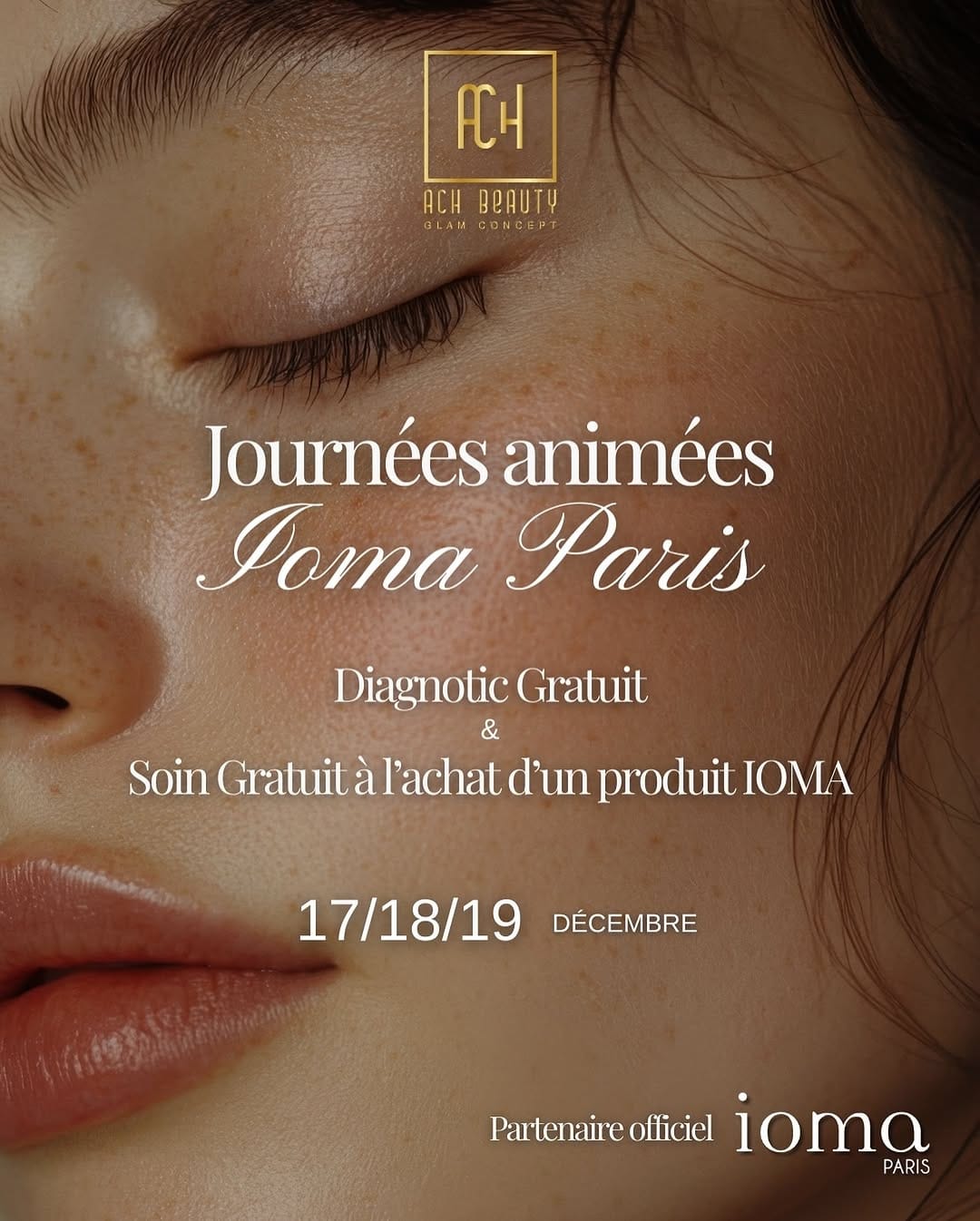Post 7 by ACH BEAUTY on Instagram (image)
