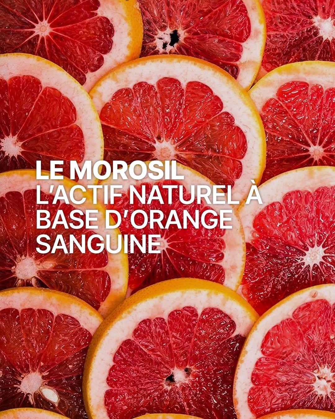 Post 3 by Novoma on Instagram (carousel)
