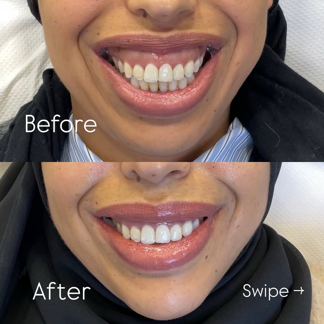 Post 2 by Ambre Clinic on Instagram (carousel)
