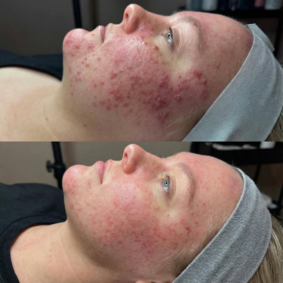 Post 3 by My Laser Center on Instagram (image)