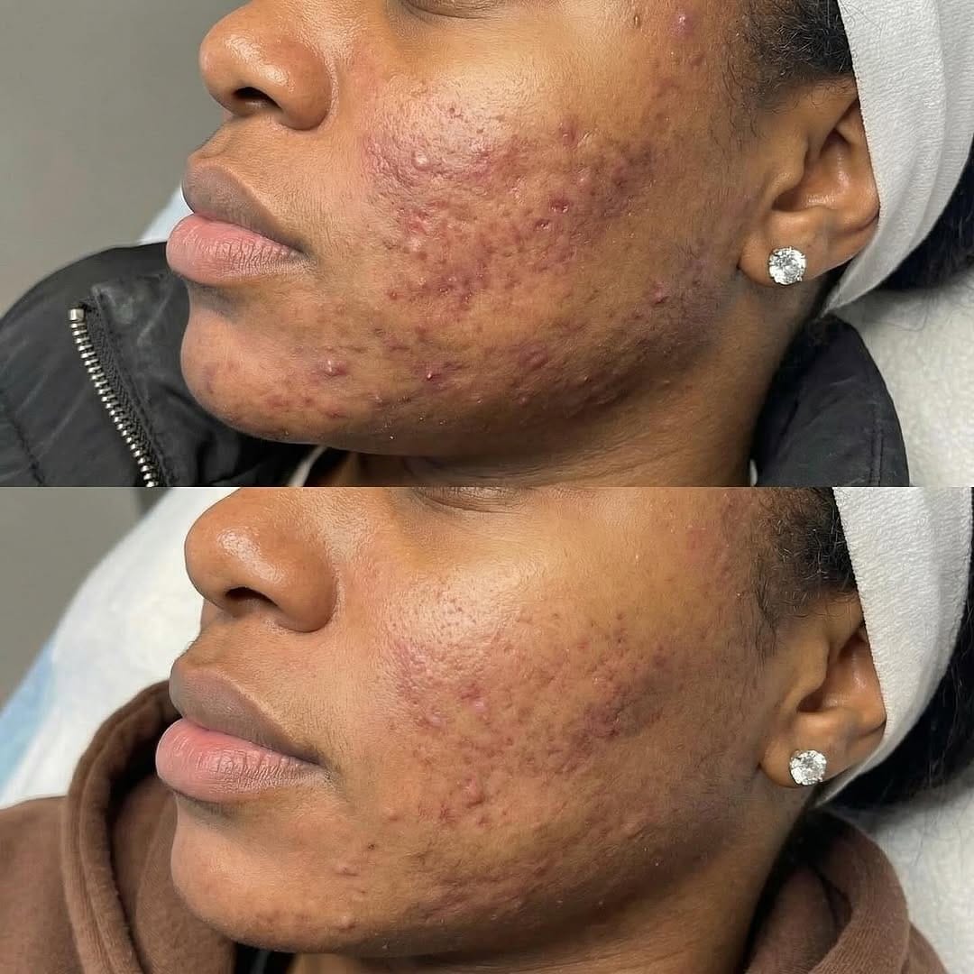Post 6 by My Laser Center on Instagram (image)