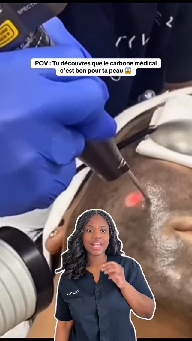 Post 5 by My Laser Center on Instagram (video)